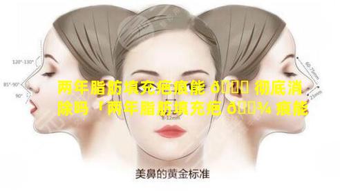 两年脂肪填充疤痕能 🐒 彻底消除吗「两年脂肪填充疤 🌾 痕能彻底消除吗多少钱」